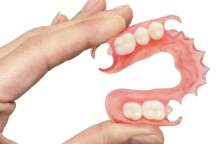 Нейлоновые зубные протезы в Балашихе